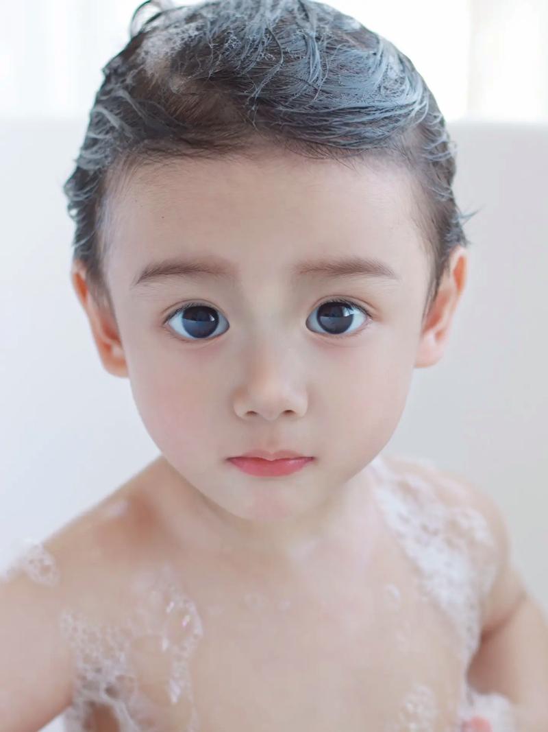 怎么治疗失眠性抑郁症